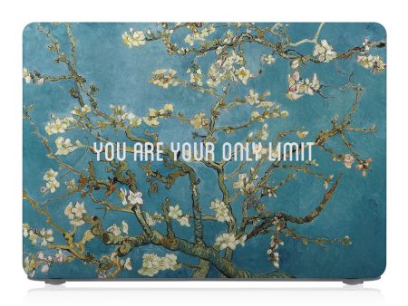 Macbook Case - Positive Quote - You Are Your Only Limit Supply